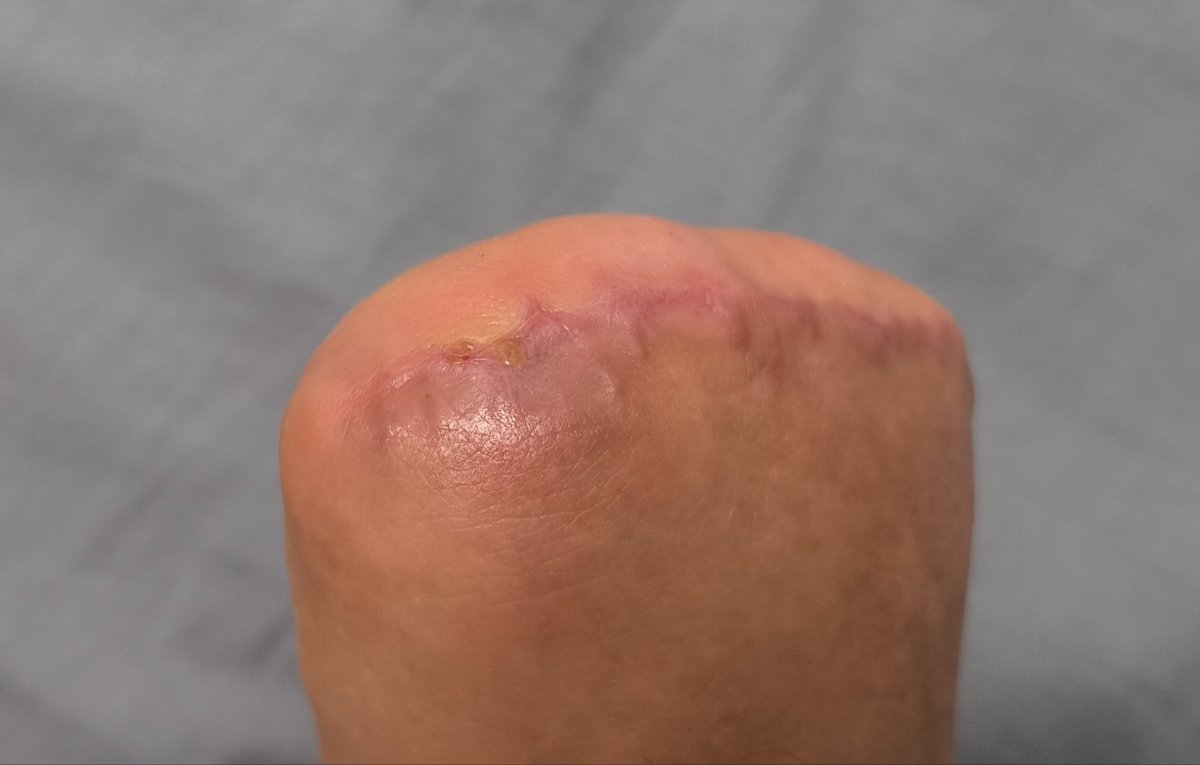 Man with small feet tweet media