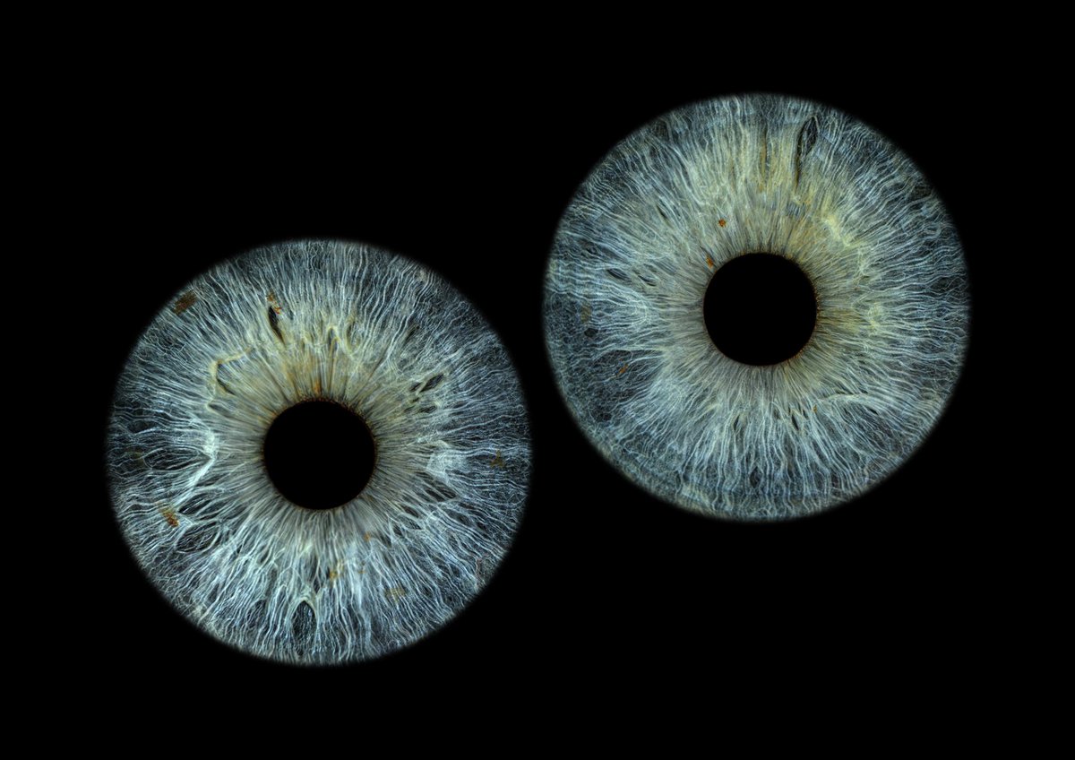 1. Фото моих глаз
2. Дочкины
3. Моего мужа 

Хоть он не био папа, забавно, как в дочкиных глазах как бы есть и тот, и тот цвет