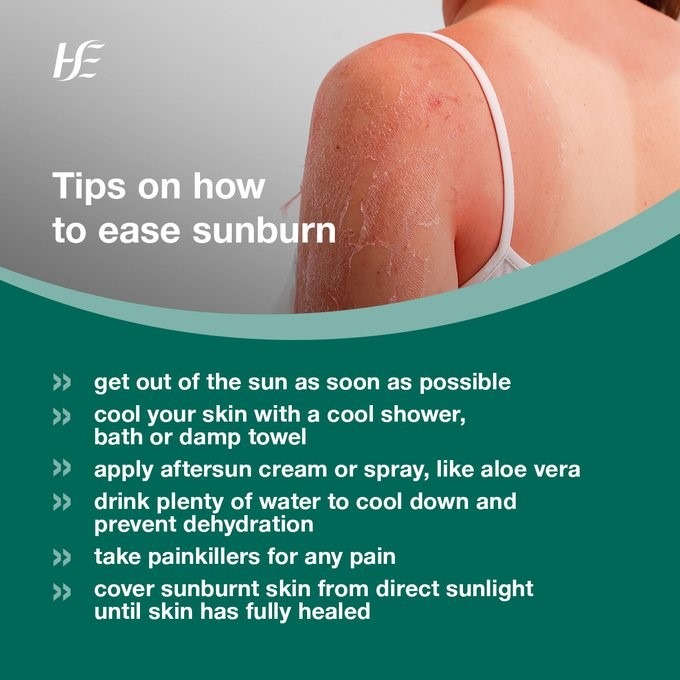 HSEDubMidlands's tweet image. Do everything you can to avoid getting sunburnt as severe sunburn can lead to heat exhaustion and heat stroke. These can be very serious.
Find out how you can ease the symptoms of sunburn: pulse.ly/khkwzt2pfm