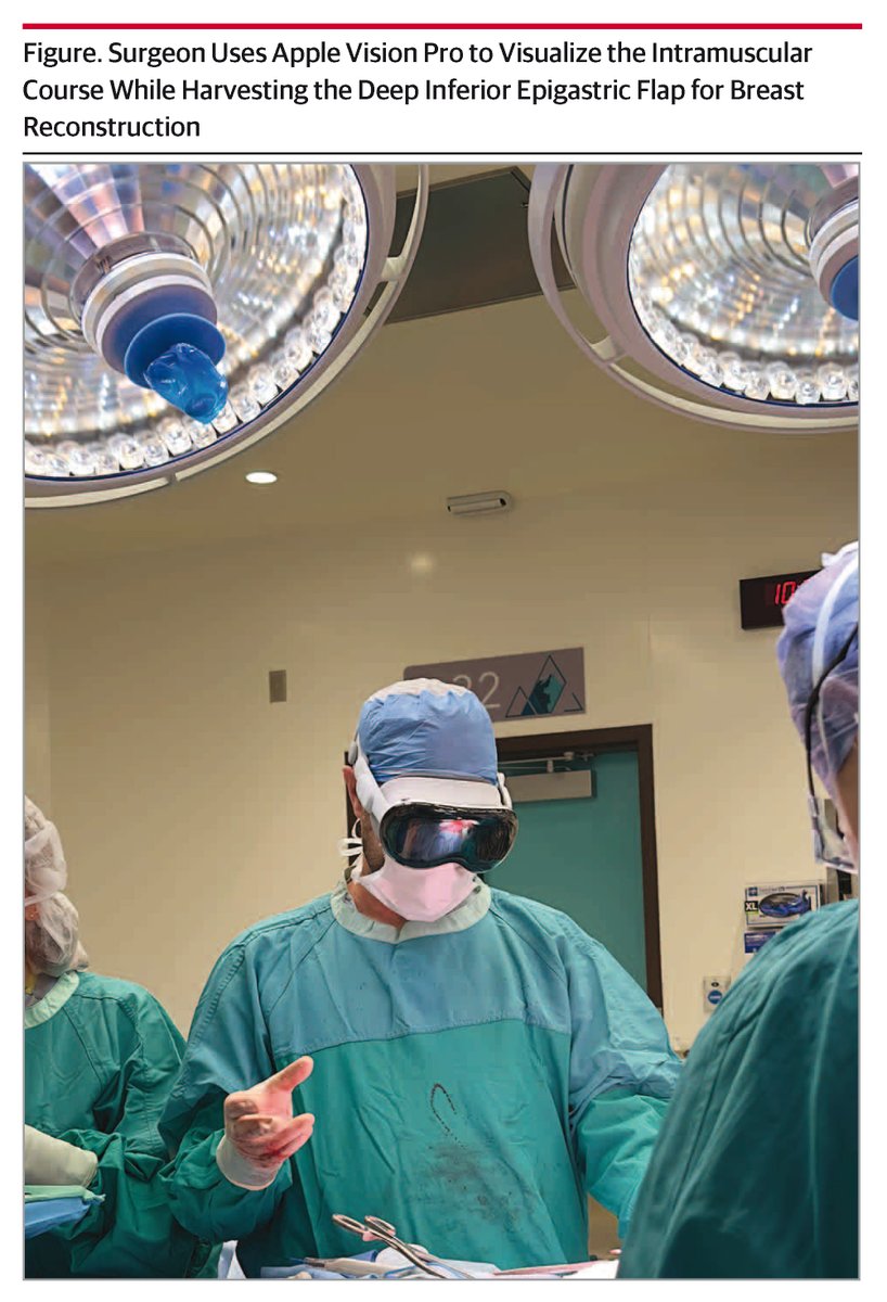 JAMASurgery's tweet image. Augmented reality (AR) enhances surgical procedures by overlaying patient-specific anatomy onto the surgeon's view, improving visualization, decision-making, and potentially reducing operative times and complications. ja.ma/4nAMaTE