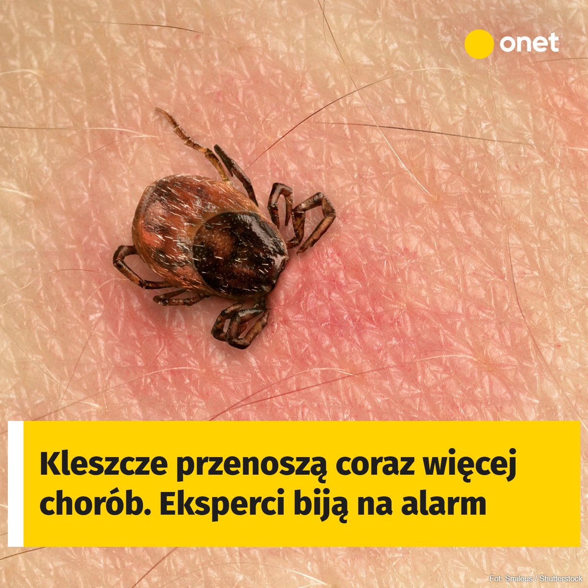 Polacy lekceważą zagrożenie ze strony kleszczy. Szczegóły ➡️ klhttps://wiadomosci.onet.pl/kraj/polacy-nie-dbaja-o-ochrone-przed-kleszczami-liczba-chorob-rosnie/cemczdv?utm_term=autor_5&amp;utm_source=twitter&amp;utm_medium=social&amp;utm_campaign=onetwiadomosci-page-post