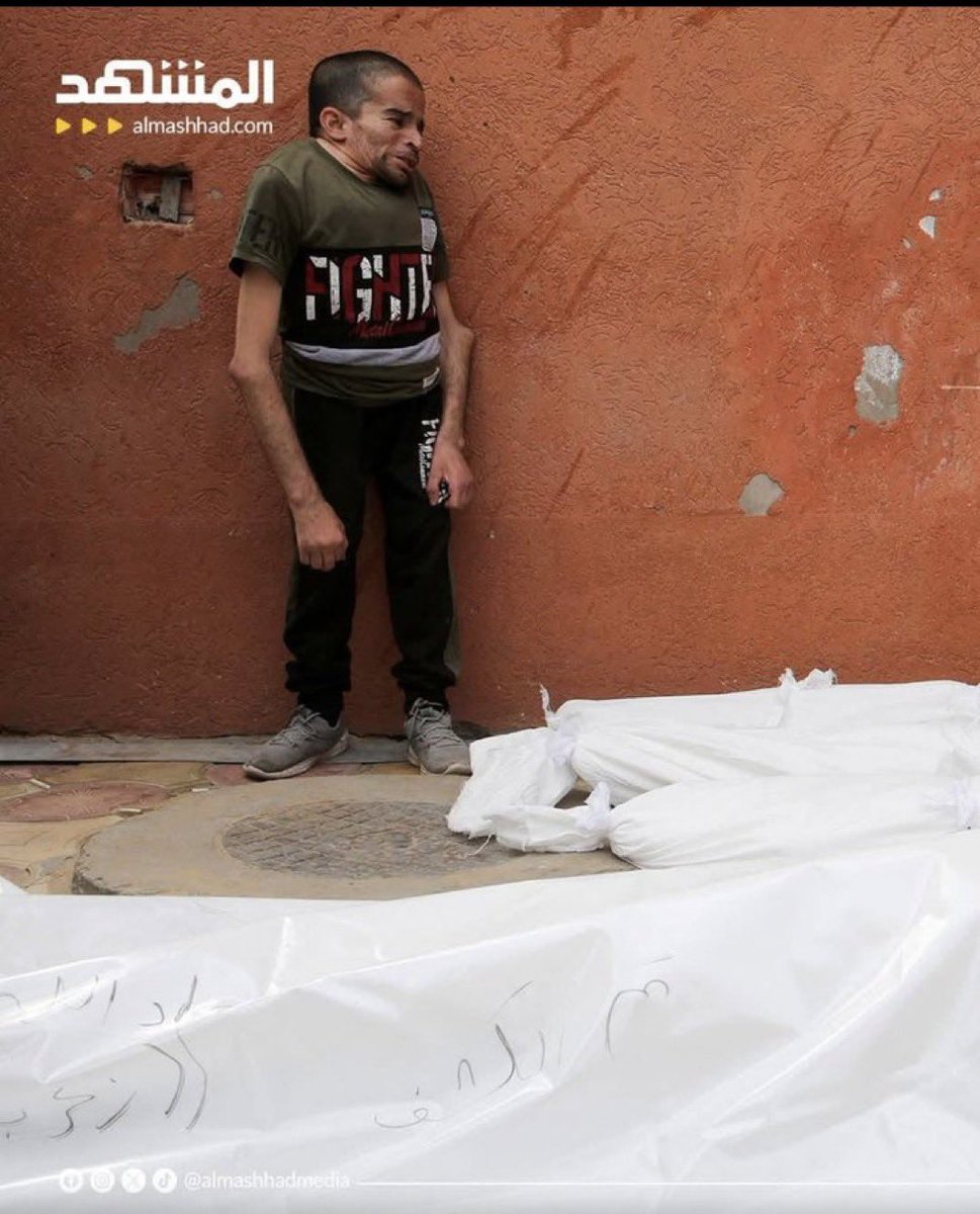 İsrail hava saldırısında tüm çocuklarını ve karısını kaybeden bu engelli adamın hali İslam alemine zillet olarak yeter…