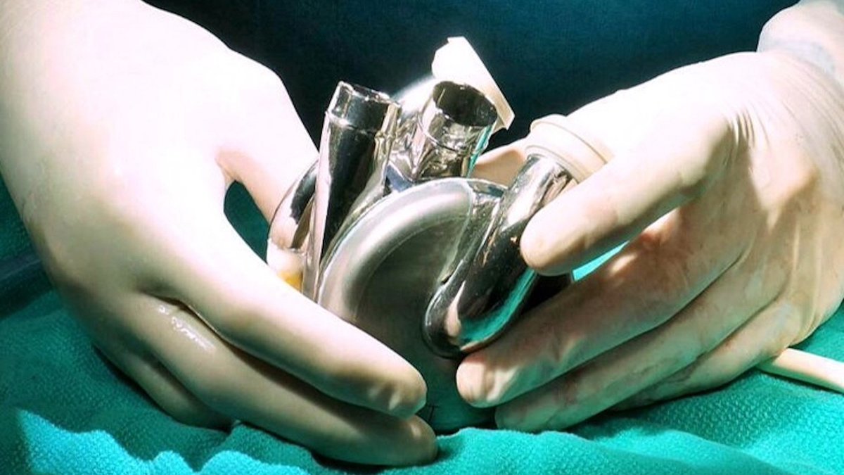 One year ago today, history was made at THI as the first BiVACOR Total Artificial Heart was implanted in a 57-year-old man who suffered from heart failure. Congratulations to our patient and the entire #BiVACOR, team for this amazing accomplishment in cardiovascular health.