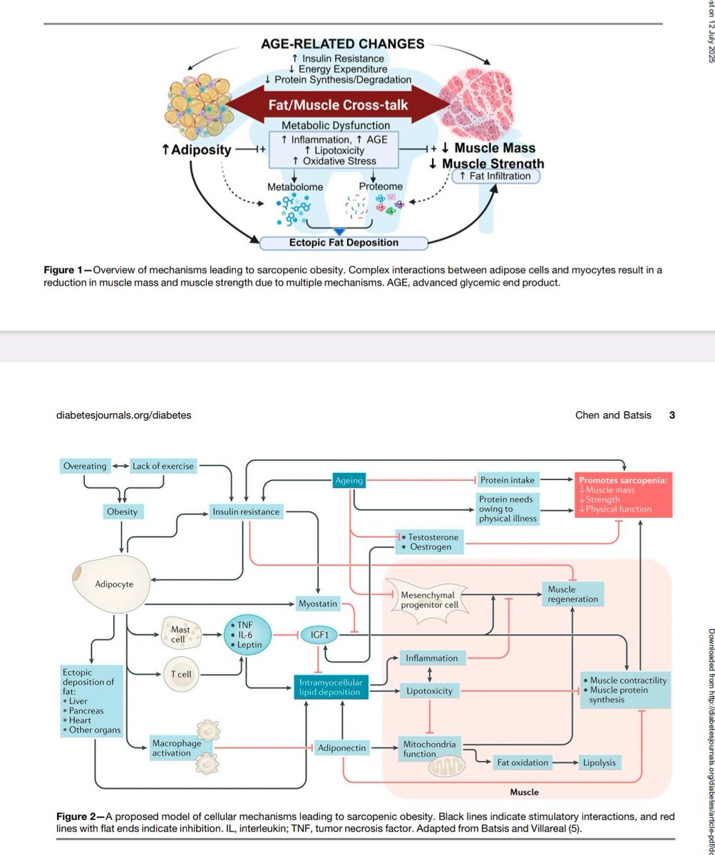 giorg_kyriakos's tweet image. 📌 #Sarcopenic #obesity: a complex phenotype gaining attention in #T2D &amp;amp; #ageing

💉 #Incretin therapies (#GLP1, GLP1/GIP) reduce fat mass—but what about lean mass?

🧠 Clinical challenge: balance efficacy, muscle preservation &amp;amp; function

🔗 doi.org/10.2337/dbi25-…