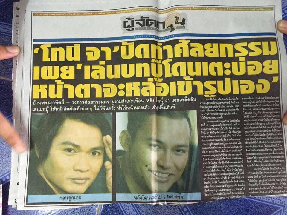 ไม่มีนะคะศัลยกรรมน่ะ