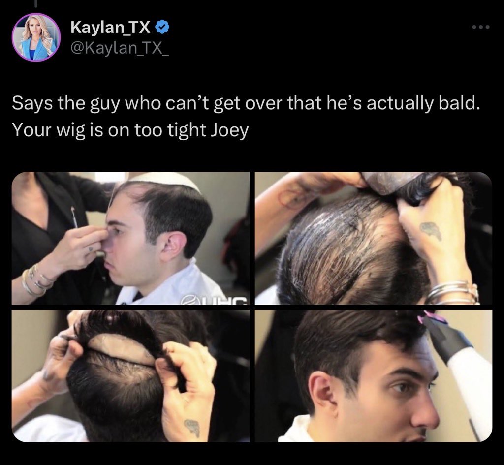 imatweet25's tweet image. WWIII happened on Joey’s scalp! The fake hair conquered!
