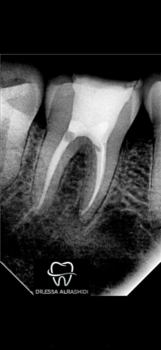 عيسى الرشيدي tweet media