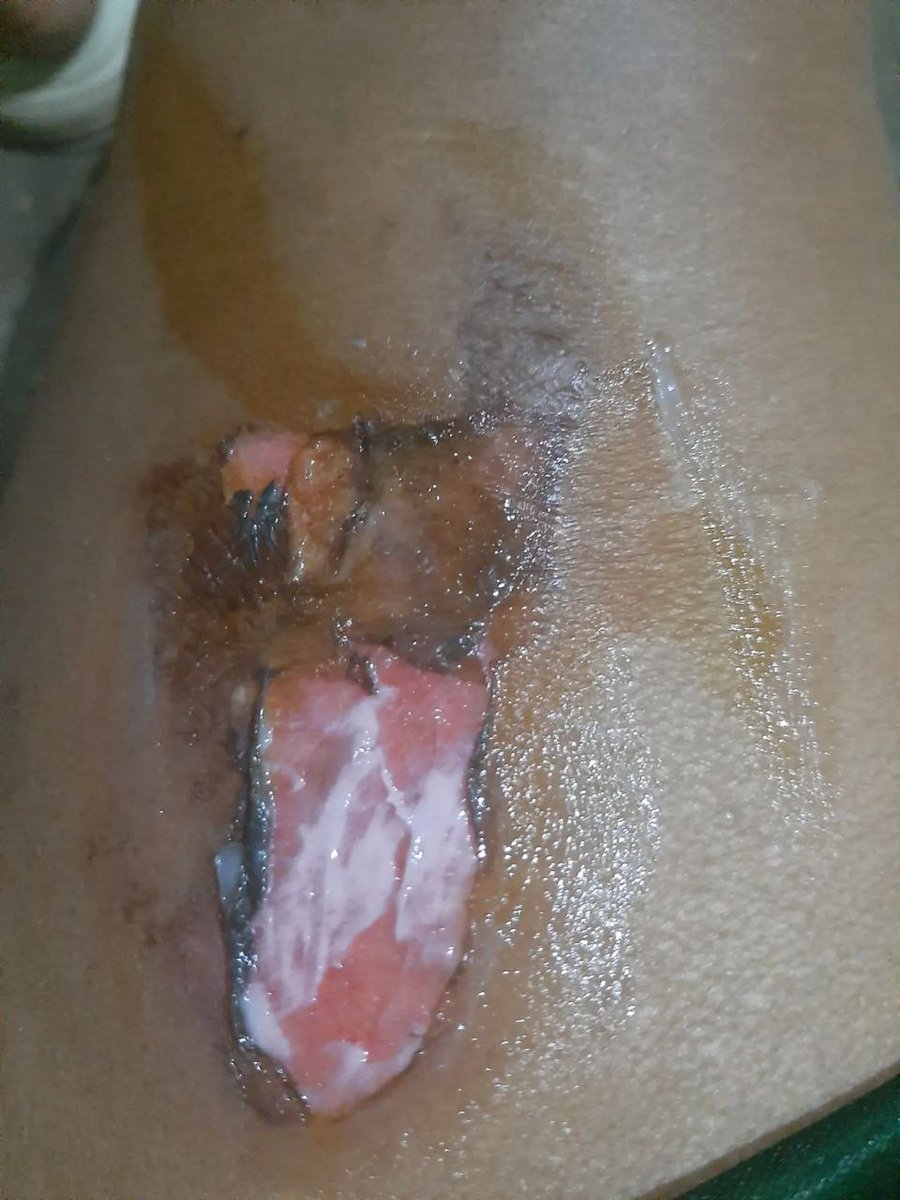 Olbana ibsa (@ibsaolbana) on Twitter photo 