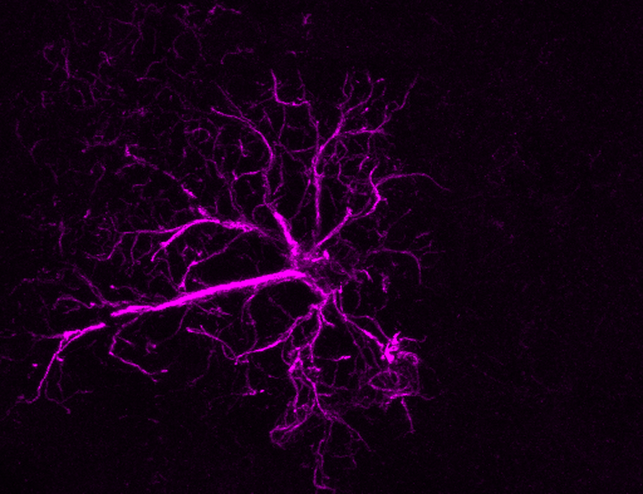 scisignal's tweet image. An experimental drug for genetic #ParkinsonsDisease can prevent the harmful effects of a mutant protein on neurons and cilia, suggesting that early treatment might benefit patients bearing certain disease-linked mutations. @pfeffersuzanne @StanfordDeptMed scim.ag/3TI6Njn
