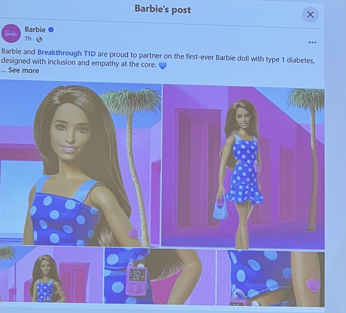 Ruchi Mathur MD (@ruchimathurmd) on Twitter photo Type 1 Diabetes Barbie has made her scientific debut.<a href="/TheEndoSociety/">Endocrine Society</a> #Barbie #ENDO2025 Type 1 Diabetes Barbie has made her scientific debut.<a href="/TheEndoSociety/">Endocrine Society</a> #Barbie #ENDO2025