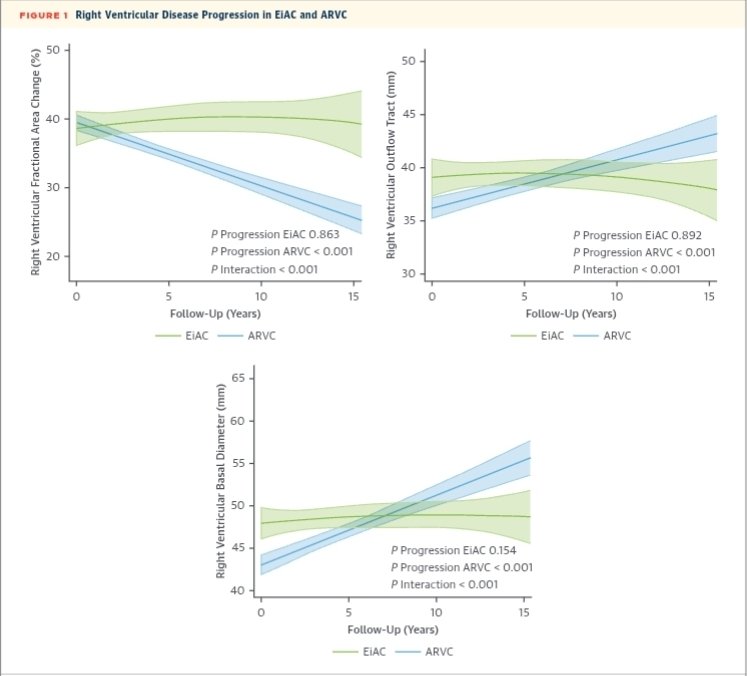 MasriAhmadMD's tweet image. Interesting paper on outcomes of ARVC vs exercise induced phenotype
jacc.org/doi/epdf/10.10…
Structure remains stable in exercise induced phenotype while arrhythmia occurrence was similar
#cardiotwitter