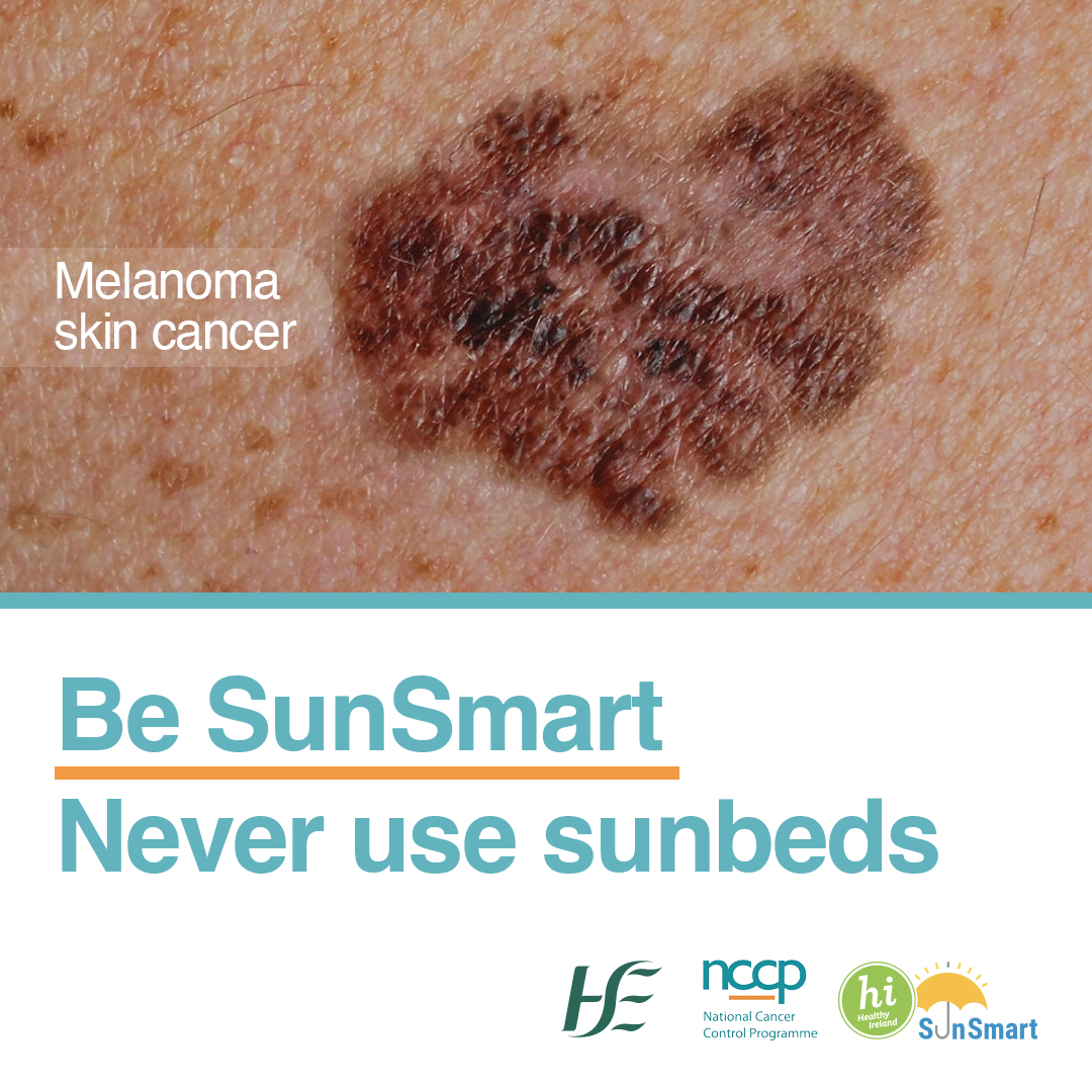 Using sunbeds for the first time before the age of 35 increases your risk of developing melanoma skin cancer by 75%. 

Be #SunSmart and never use sunbeds. 

Learn more: bit.ly/3IndzIJ