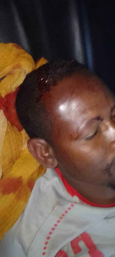 3moryco1's tweet photo. اتمنى الناس كلها تشير

اللاجئين السودانيين بموتوا الان في يوغندا، مجموعات مسلحة من جنوب السودان بتعتدي على السودانيين ليل نهار في المعسكر.

اليومين الفاتو كان رعب حقيقي لكل اللاجئين السودانيين
وحتى الان ماف اي تدخل من الشرطة اليوغندية "احساس هم لاجئين في بعض ما عندنا ليهم شي" https://t.co/74cNw1YUOo