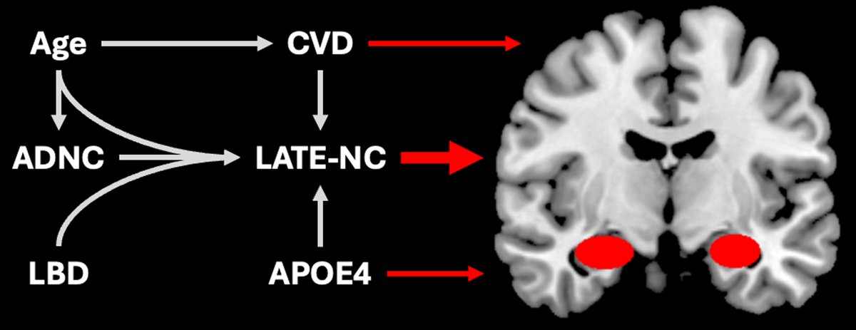 Brain1878's tweet image. The converging paths to hippocampal sclerosis of ageing: insights from LATE-NC and vascular disease
New scientific commentary by Ryan Coburn and Hugo Botha tinyurl.com/3ffhrkm7