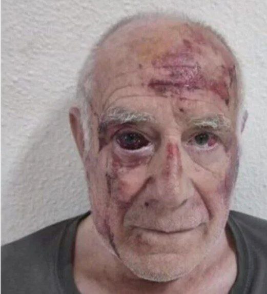 Das ist Domingo, ein älterer spanischer Herr. 
Auf ihn hatten islamische Nordafrikaner am Mittwoch völlig grundlos eingeprügelt, sie hätte ihn fast getötet. Nun sind die Einwohner von Torre-Pacheco und der Umgebung an dem Punkt angekommen, um zur Gegenwehr überzugehen. 
Von der