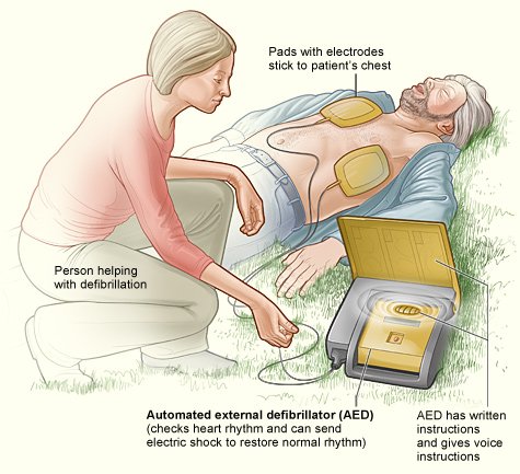 Such good news today 🤗
2 months after delivering a CPR &amp; AED awareness session to Mongeham parish Council, they have now purchased a state of the art Defibrillator to replace their previous aged model ⚡️
Cardiac arrest is a community issue so this is FABULOUS NEWS 🙌💓<a href="/Deal_Town/">Deal Town</a>