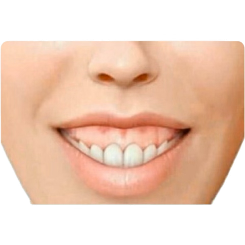 Hey girl! How’ve you been?? Do you recall not long ago we would walk on the sidewalk? Haha. Innocent, remember? All we did was care for each other