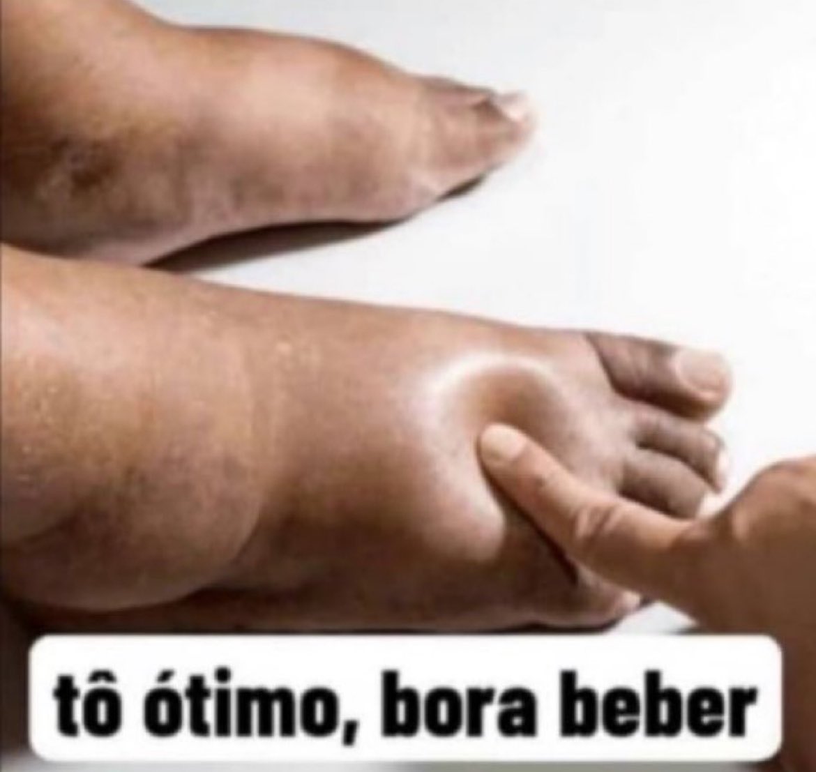 caralitico's tweet image. 