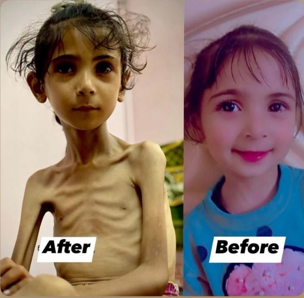 Just imagine this was your child.