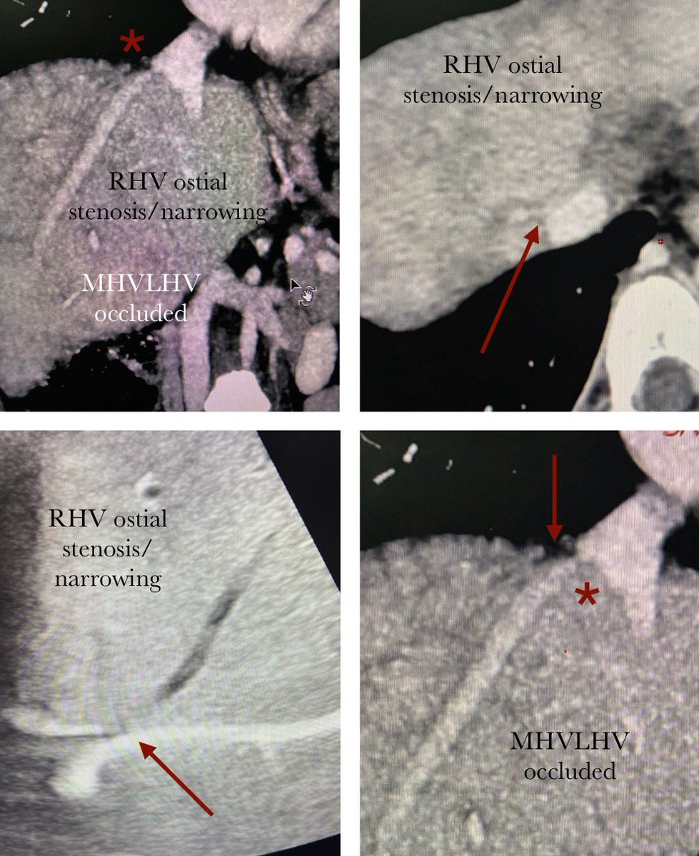 Karan Anandpara tweet media