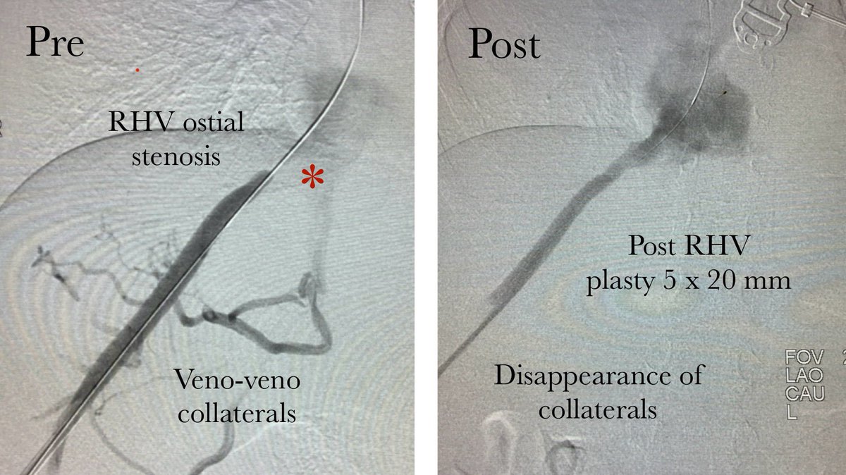 Karan Anandpara tweet media