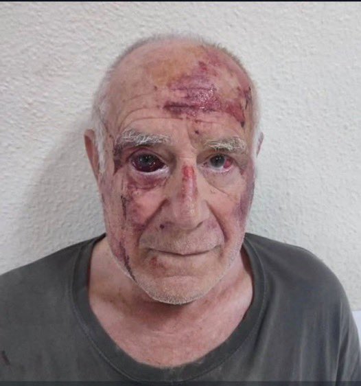ShockFeed1's tweet image. After a Moroccan group allegedly attacked an elderly man in Torre-Pacheco, Spaniards from across the country are now taking matters into their own hands. With police and politicians failing, locals say enough is enough. 🇪🇸⚠️ #TorrePacheco
