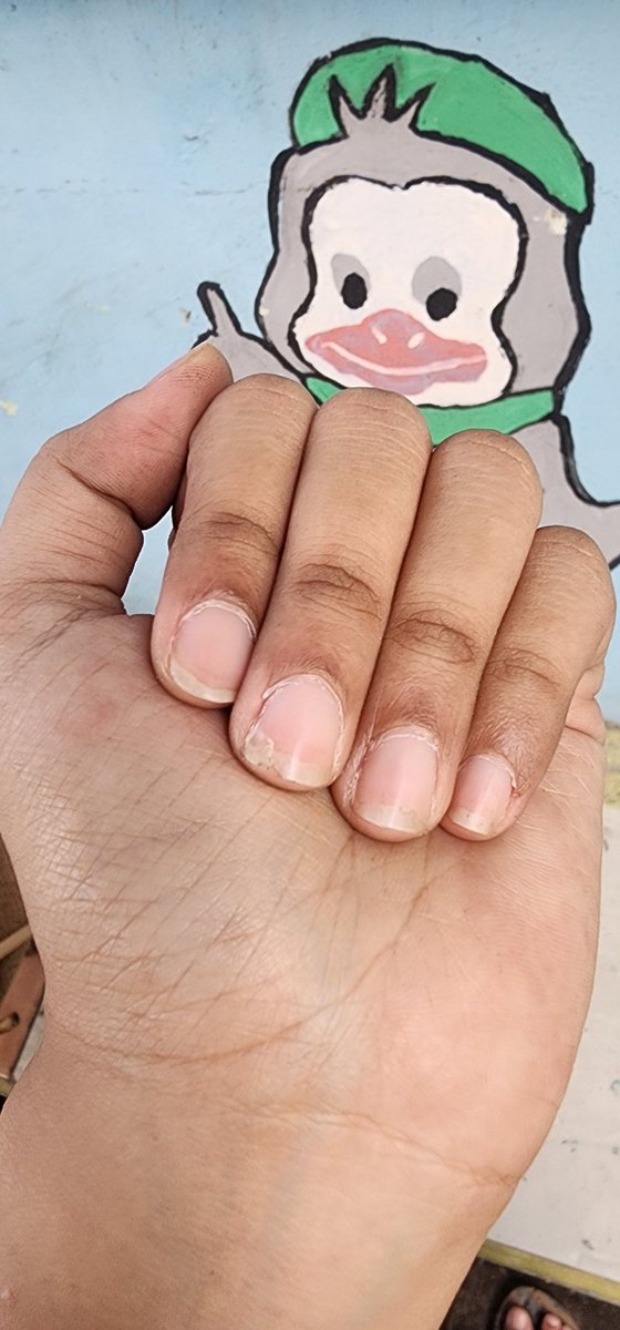 voidcrumb's tweet image. Lupa belum potong kuku, padahal hari ini kegiatannya kasar😭😭