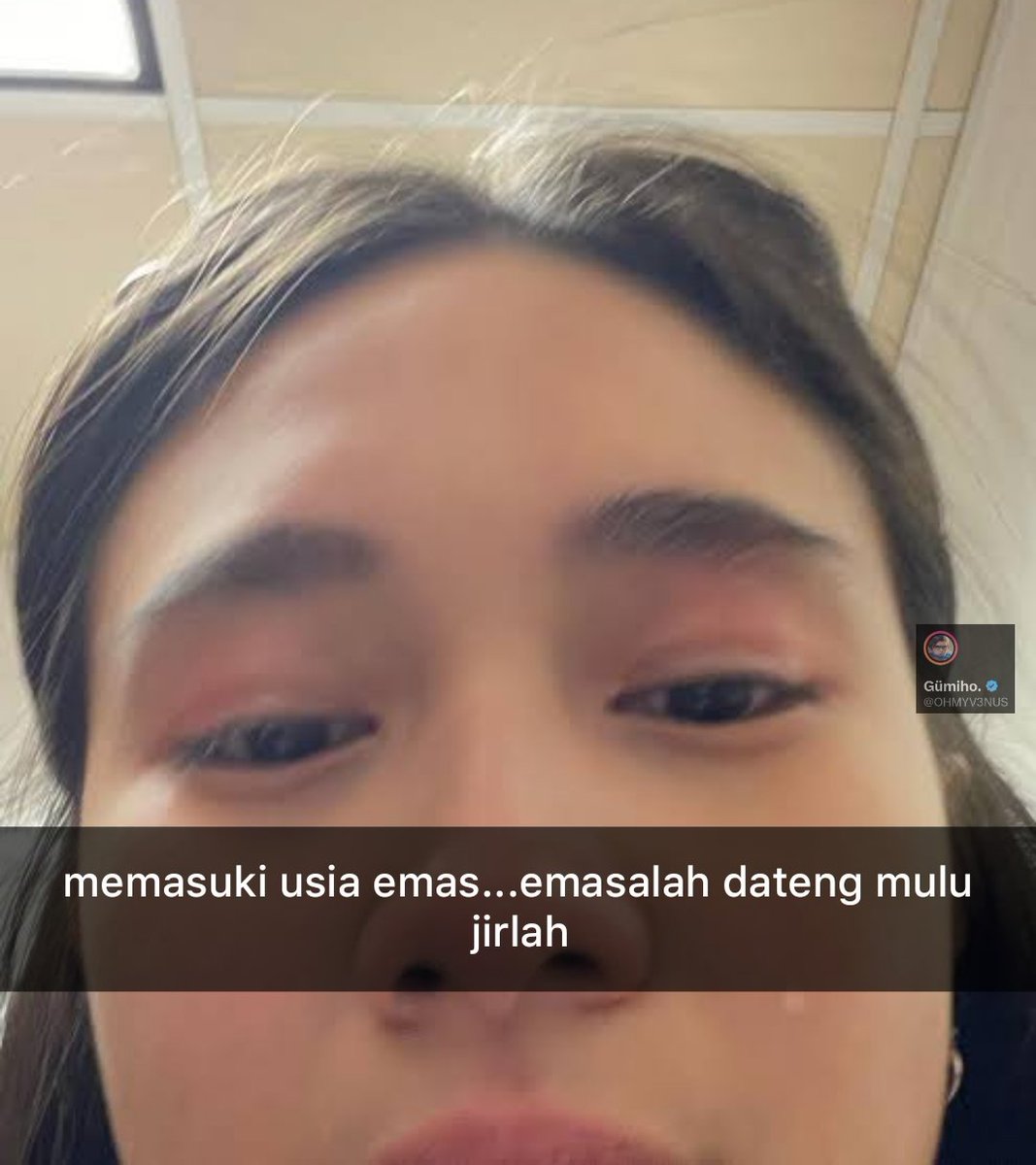 Gümiho. (@ohmyv3nus) on Twitter photo 