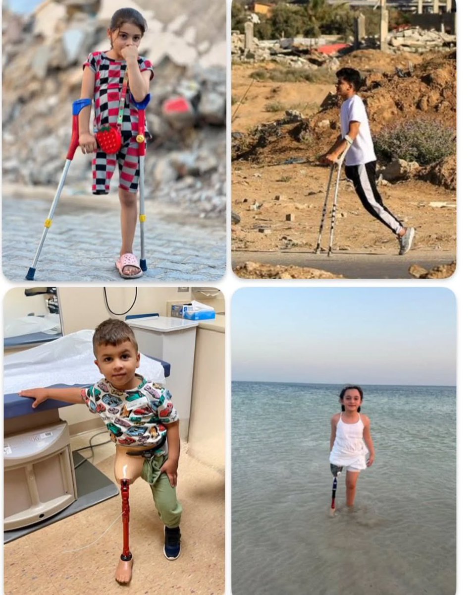 EyeonPalestine's tweet image. Gaza today has the largest number of people who have lost limbs in the world.
Since the start of the latest war:
Over 4,500 people have lost their limbs
Among them, 850 are children
Every day, more than 10 children suffer injuries that result in the loss of limbs
The healthcare…