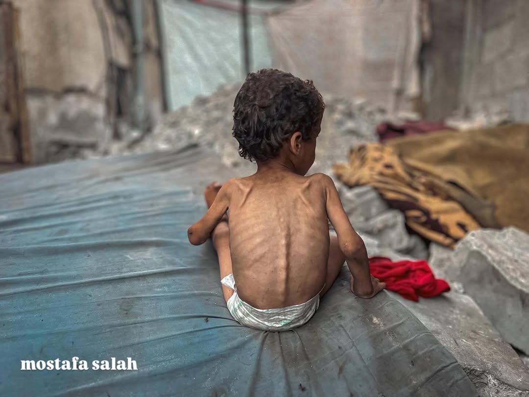 الجوع فى غزة نهش اجساد الصغار 💔