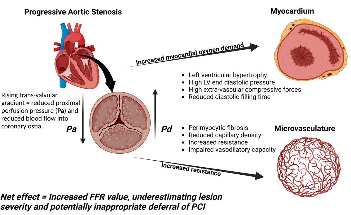 Functional assessment of coronary artery disease in patients with severe aortic stenosis: a review - bit.ly/4iELU2H