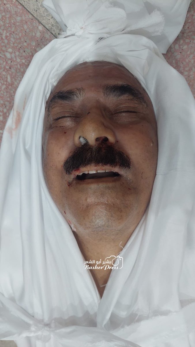 🚨 إسرائيل تقتل قبل قليل أحد أشهر أطباء غزة — الدكتور أحمد قنديل، استشاري الجراحة العامة في المستشفى المعمداني.

استُهدف في قصف إسرائيلي على سوق شعبي عند مفترق السامر وسط مدينة غزة، ما أدى إلى ارتقاء وإصابة نحو 70 مواطنًا.