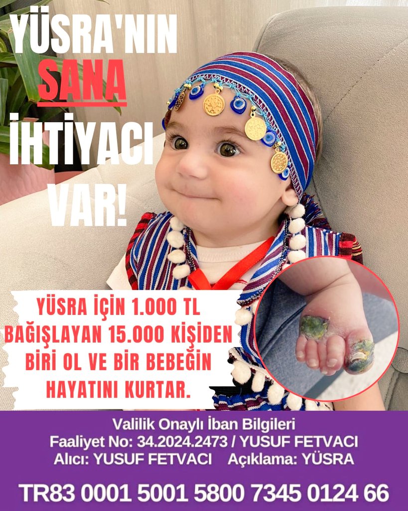 nurcin_klc's tweet image. Hayde Karadeniz! 
Haydi Türkiye! 
Son bir destekle YÜSRA ilacına kavuşsun. ‼️
Çay tv de büyük gecesine davetlisiniz. 📌
Pazartesi 21:00 🔈
— Sma Yüsra Fetvacı için hep birlikte 🇹🇷
#pazar 
#FileninSultanları 
Gündem #smatype1
Haberler
✈️Kahramanım olur musunuz YALVARIYORUZ ✈️