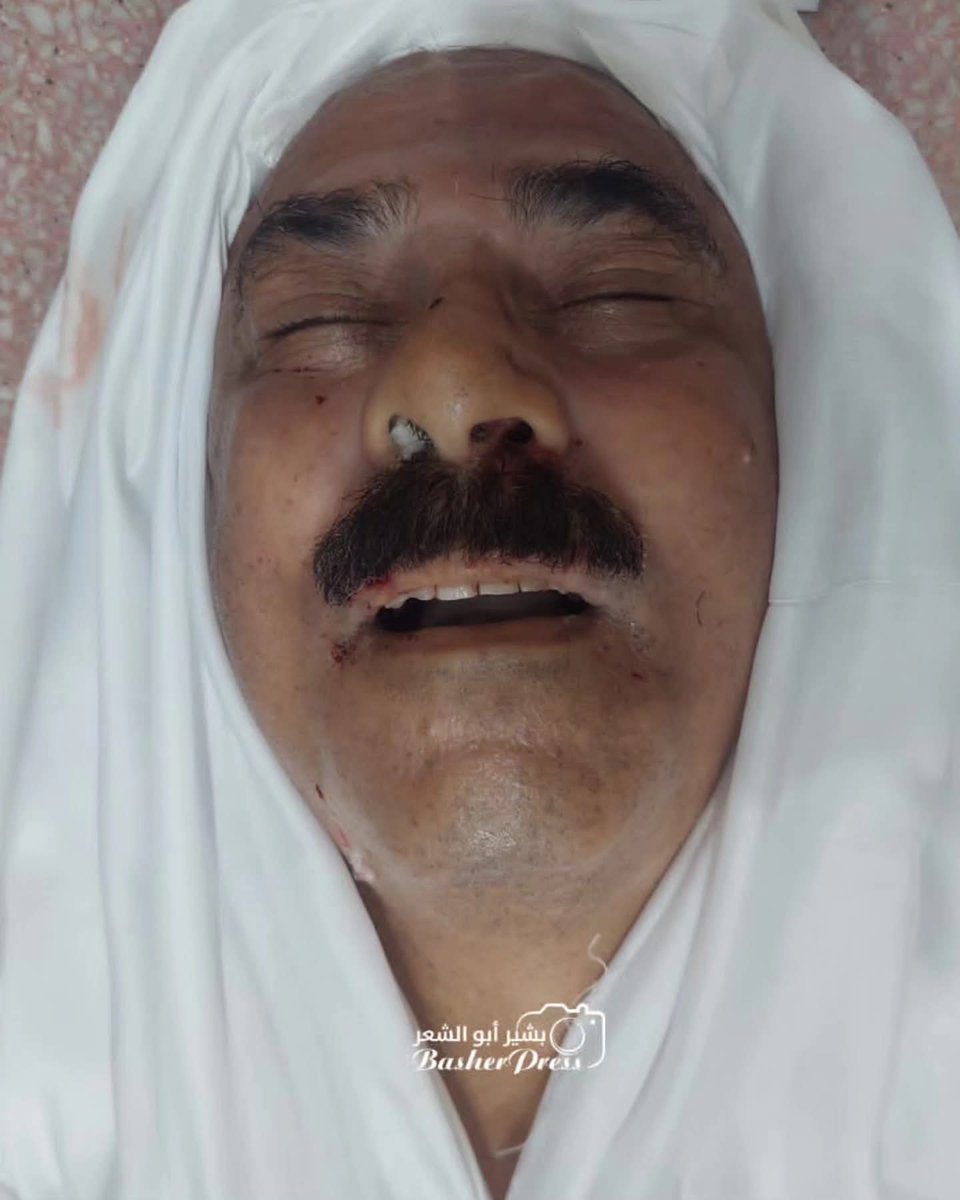الله يرحم روحك الطاهرة يا دكتور أحمد قنديل .
حسبنا الله ونعم الوكيل 
الدكتور الإنسان المعطاء.

#غزة