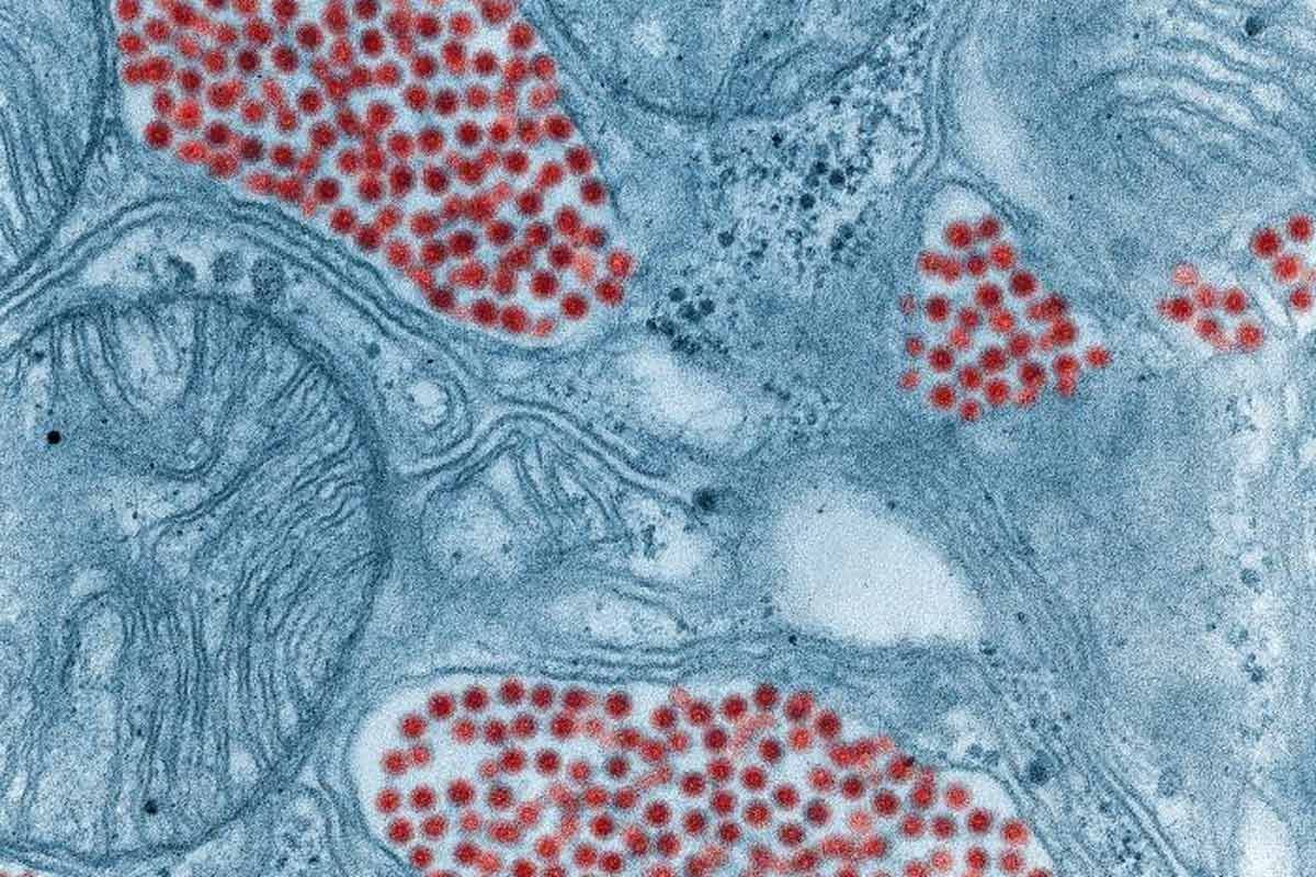 Eastern equine encephalitis (EEE) was once confined to swampy pockets of the US. Now it’s appearing in more states, with no vaccine and no cure. 
 
What we know so far: bit.ly/4eHla0H