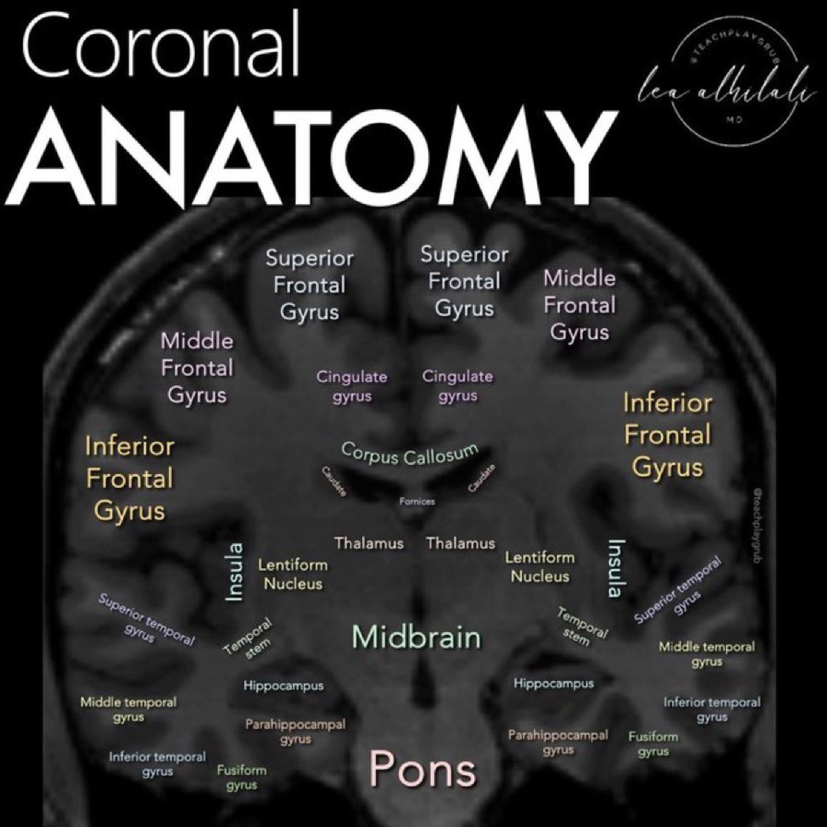Coronal temporal lobe anatomy <a href="/teachplaygrub/">Lea Alhilali, MD</a> #MedEd #TIC2025
