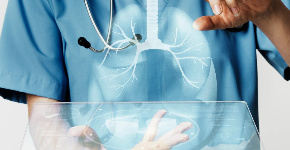 La contaminación, responsable del cáncer de pulmón en no fumadores, según un gran estudio genómico bit.ly/4kGhEFs @Constantesyvitales