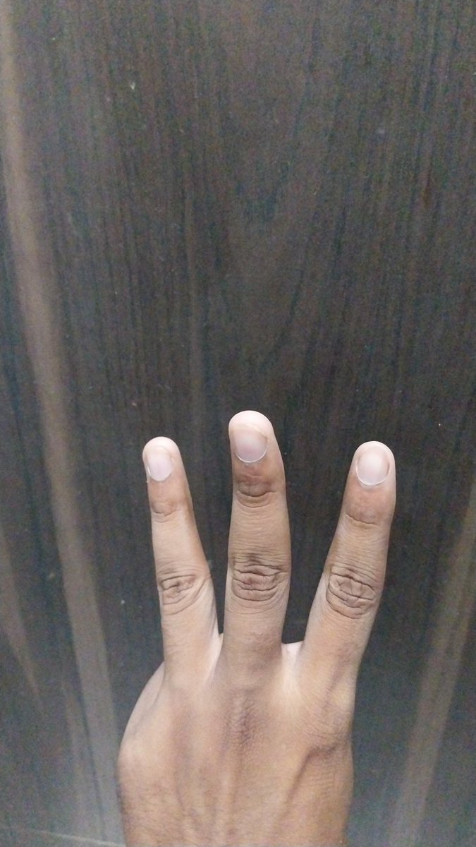 Watchers everywhere and everytime..
#WatchersEverywhere #WatchersEverywher #everywhere #denet <a href="/DeNetPro/">DeNet</a>