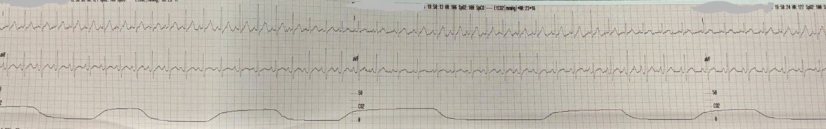 Owen Wood tweet media