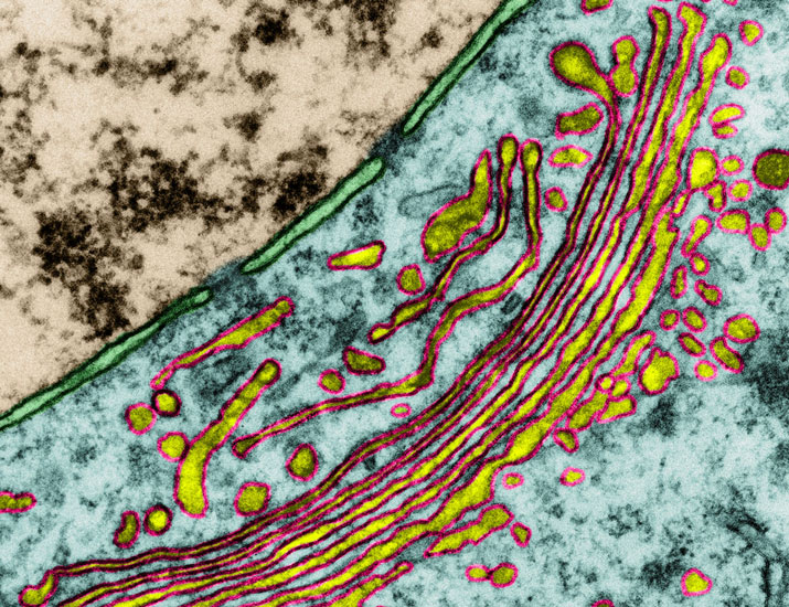 scisignal's tweet image. A recent preclinical study identifies a mutant kinase connected to familial #AlzheimersDisease and provides insights about its signaling and abnormal localization that could inform future research into new therapeutics. @RudyTanzi @NewtonLab @UCSDPharm scim.ag/44oRiD7