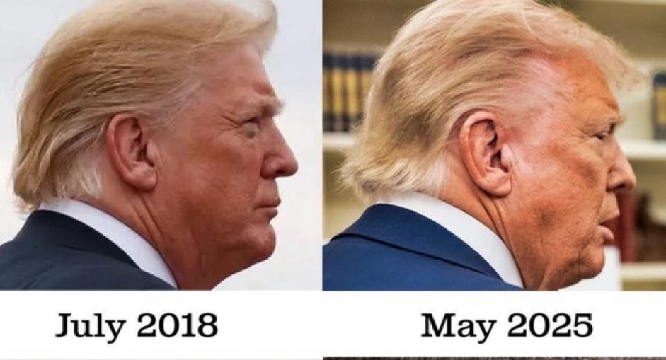 One year ago Trump was shot. 

Do you believe the assassination attempt was genuine or staged?