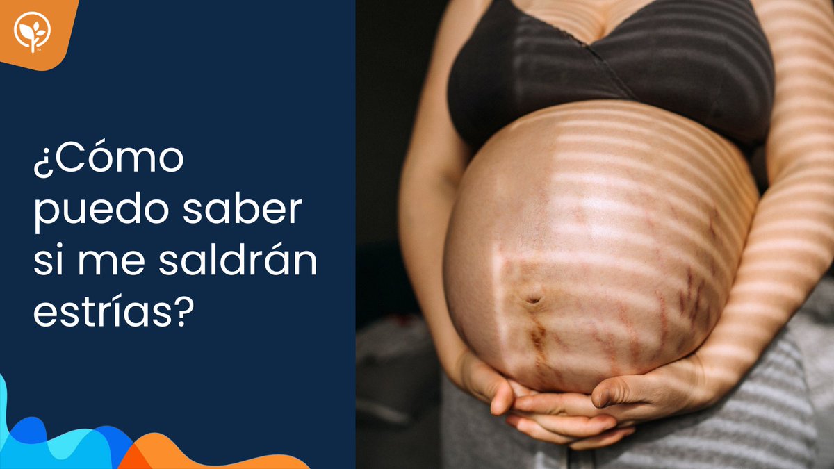 ¿Se pueden prevenir? Todo lo que debes saber sobre las estrías en en embarazo: bit.ly/446LXyh