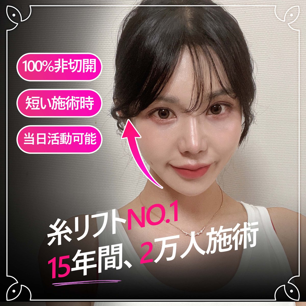 韓国糸リフト, 第1位の病院 狎鴎亭ミラクル (@miraclelifting) on Twitter photo 狎鴎亭ミラクル医院
🩷Instagram🩷 : instagram.com/miraclelps_jp/
💚 Line ID 💚:@miracleps_japan
🔹E-MAIL🔹: mirakleps@gmail.com
糸リフトの NO1! ついに日本本土上陸間近!
👉シワ、たるみ まだお悩みですか?
👉韓国糸リフト、第1位の病院
👉100%非切開、10分施術で10年若返り 狎鴎亭ミラクル医院
🩷Instagram🩷 : instagram.com/miraclelps_jp/
💚 Line ID 💚:@miracleps_japan
🔹E-MAIL🔹: mirakleps@gmail.com
糸リフトの NO1! ついに日本本土上陸間近!
👉シワ、たるみ まだお悩みですか?
👉韓国糸リフト、第1位の病院
👉100%非切開、10分施術で10年若返り