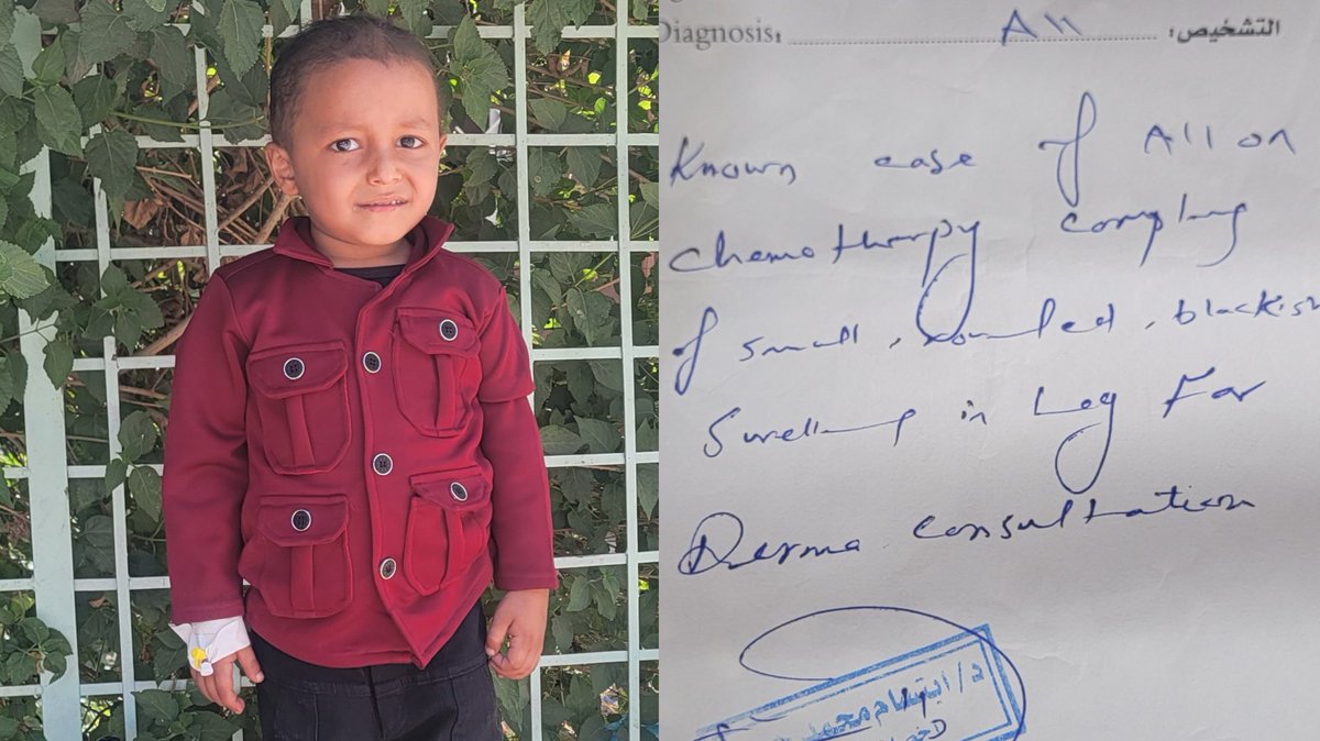 TRT4Yemen's tweet image. 🚨MEDICAL THREAD🎗
Medical Update on Baby Waleed
Waleed, our brave little fighter from #Yemen, with a known case of Acute Lymphoblastic #Leukemia (ALL) and is currently undergoing chemotherapy.
(gofund.me/539c83c4)
Recently, his parents noticed a small, dome-shaped blackish…
