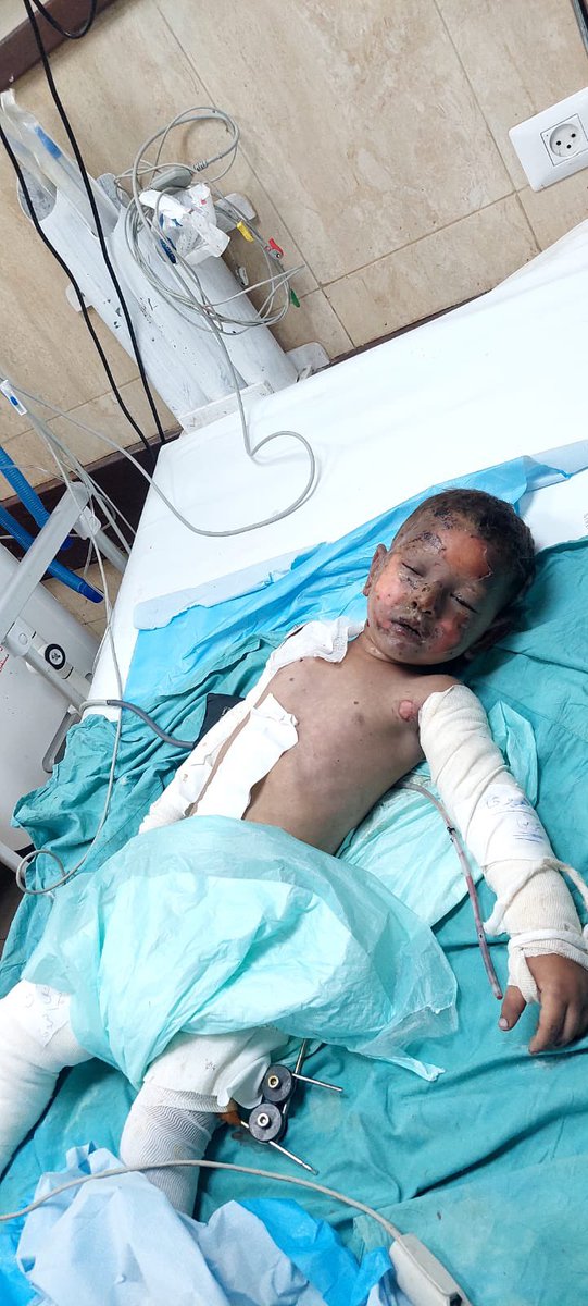 غيث القريناوي عامين لم يتحمل جسده الصغير صاروخ الاحتلال ولا أن يرحل أمه وأبيه ويبقى دونهم.
 فارق الحياة بعد ألم شديد من الحرق والجراح التي امتدت في كل جسده.