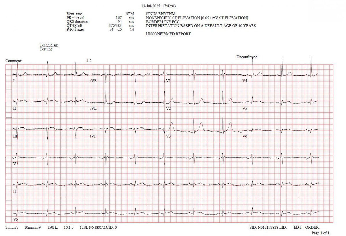 43 years old man presents to ED with chest pain.
What’s next?