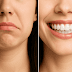 refreshskin88's tweet photo. How Can I Feel More Confident About My Smile? - https://t.co/dVhV5TD1p5 ##skincare#Skincareroutine#beauty#skin#skincaretips#Skincareproducts #2025 #news #skincareroutine https://t.co/DFyGpzVmLI