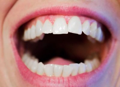 falseteethoptns's tweet photo. How do dentures stay in place? 🤔 From natural suction to special adhesives, we've got the answers!🦷 https://t.co/vsHhJb6zPu #DentureFacts https://t.co/Qk1avS45WC