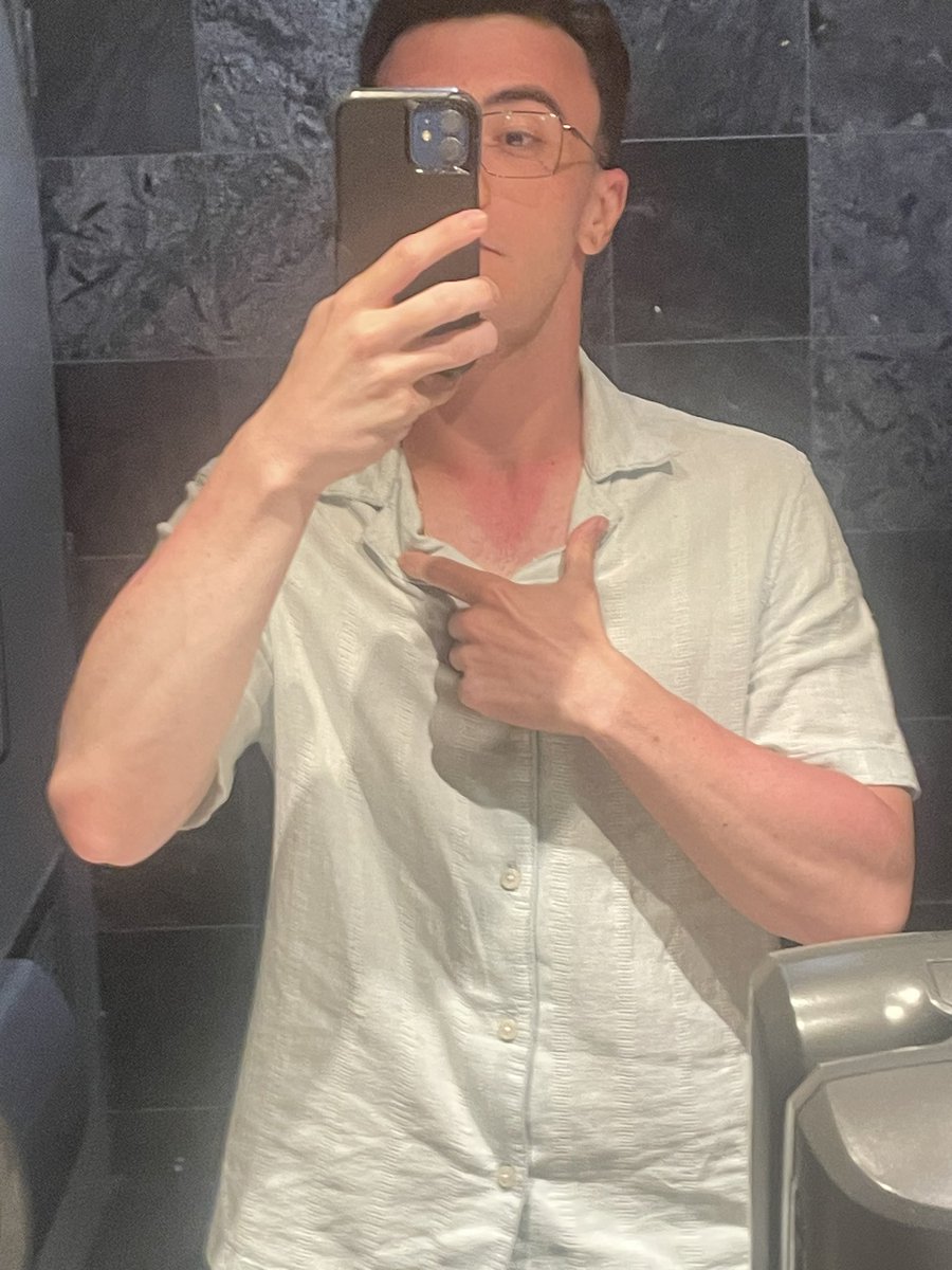 Don’t think i’ve ever been more sun burnt in my life😭😭