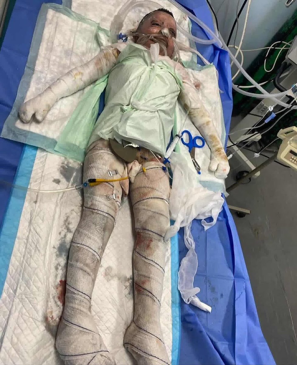 Timesofgaza's tweet photo. The child, Omar Al-Hosari (12 years old), is the sole survivor of his family after their home was bombed. https://t.co/j8pdS5R6E8
